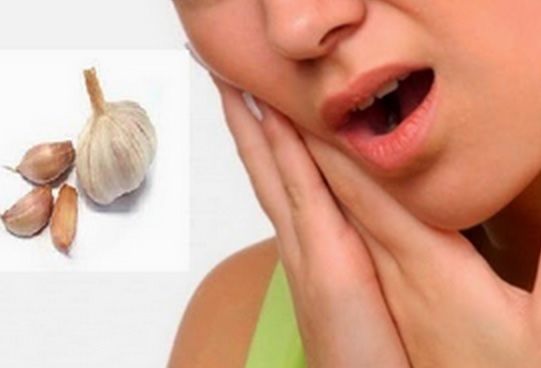Sifat antibakteri pada bawang putih dapat mengobati sakit gigi dan gusi yang membengkak.