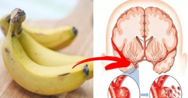 Menambahkan pisang dalam daftar diet harian mampu menghindarkan Anda dari banyak sekali macam p 11 Manfaat Pisang untuk Diet, Kesehatan, dan Kecantikan